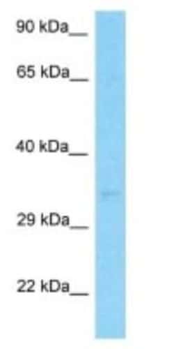 SERHL2 Rabbit anti-Human, Polyclonal, Novus Biologicals 100 &mu;g; Unconjugated:Antibodies,
